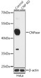 Western blot analysis of lysates from wild type (WT) and CNPasease knockout (KO) HeLa cells, using [KO Validated] CNPase Rabbit polyclonal antibody (STJ119982) at 1:1000 dilution. Secondary antibody: HRP Goat Anti-Rabbit IgG (H+L) (STJS000856) at 1:10000 dilution. Lysates/proteins: 25 Mu g per lane. Blocking buffer: 3% nonfat dry milk in TBST. Detection: ECL Basic Kit. Exposure time: 90s.