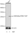 Western blot analysis of lysates from HeLa cells, using Phospho-CDKN1B/p27KIP1-T187 Rabbit pAb (STJ22066). <br/>Secondary antibody: HRP-conjugated Goat anti-Rabbit IgG (H+L) (STJS000856) at 1:10000 dilution. <br/>Lysates/proteins: 25 Mu g per lane. <br/>Blocking buffer: 3% BSA.