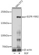 Western blot analysis of lysates from NIH/3T3 cells, using Phospho-EGFR-Y992 Rabbit pAb (STJ22098) at 1:1000 dilution. NIH/3T3 cells were treated by EGF (100 ng/mL) at 37 °C for 30 minutes after serum-starvation overnight. <br/>Secondary antibody: HRP-conjugated Goat anti-Rabbit IgG (H+L) (STJS000856) at 1:10000 dilution. <br/>Lysates/proteins: 25 Mu g per lane. <br/>Blocking buffer: 3% BSA. <br/>Detection: ECL Basic Kit <br/>Exposure time: 120s.