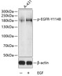 Western blot analysis of lysates from A-431 cells, using Phospho-EGFR-Y1148 Rabbit pAb (STJ22100) at 1:1000 dilution. A431 cells were treated by EGF (100ng/mL) for 30 minutes after serum-starvation overnight. <br/>Secondary antibody: HRP-conjugated Goat anti-Rabbit IgG (H+L) (STJS000856) at 1:10000 dilution. <br/>Lysates/proteins: 25 Mu g per lane. <br/>Blocking buffer: 3% BSA.