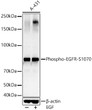 Western blot analysis of lysates from A-431 cells, using Phospho-EGFR-S1070 Rabbit pAb (STJ22101) at 1:500 dilution. A-431 cells were treated by EGF (100 ng/ml) at 37 °C for 30 minutes after serum-starvation overnight. <br/>Secondary antibody: HRP-conjugated Goat anti-Rabbit IgG (H+L) (STJS000856) at 1:10000 dilution. <br/>Lysates/proteins: 25 Mu g per lane. <br/>Blocking buffer: 3% nonfat dry milk in TBST. <br/>Detection: ECL Basic Kit <br/>Exposure time: 60s.