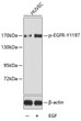 Western blot analysis of lysates from HUVEC cells, using Phospho-EGFR-Y1197 Rabbit pAb (STJ22106). <br/>Secondary antibody: HRP-conjugated Goat anti-Rabbit IgG (H+L) (STJS000856) at 1:10000 dilution. <br/>Lysates/proteins: 25 Mu g per lane. <br/>Blocking buffer: 3% BSA.
