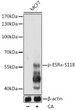 Western blot analysis of lysates from MCF7 cells, using Phospho-ESR Alpha-S118 pAb (STJ22133) at 1:1000 dilution. MCF7 cells were treated by Calyculin A (100 nM) at 37 °C for 30 minutes after serum-starvation overnight. <br/>Secondary antibody: HRP-conjugated Goat anti-Rabbit IgG (H+L) (STJS000856) at 1:10000 dilution. <br/>Lysates/proteins: 25 Mu g per lane. <br/>Blocking buffer: 3% BSA. <br/>Detection: ECL Basic Kit <br/>Exposure time: 1s.