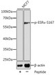 Western blot analysis of lysates from MCF7 cells using Phospho-ESR Alpha-S167 Rabbit pAb (STJ22135). <br/>Secondary antibody: HRP-conjugated Goat anti-Rabbit IgG (H+L) (STJS000856) at 1:10000 dilution. <br/>Lysates/proteins: 25 Mu g per lane. <br/>Blocking buffer: 3% BSA.