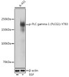 Western blot analysis of lysates from A-431 cells, using Phospho-PLC gamma 1 (PLCG1) -Y783 Rabbit pAb (STJ22333) at 1:1000 dilution. A-431 cells were treated by EGF (25 Mu g/mL) at 37 °C for 30 minutes after serum-starvation overnight. <br/>Secondary antibody: HRP-conjugated Goat anti-Rabbit IgG (H+L) (STJS000856) at 1:10000 dilution. <br/>Lysates/proteins: 25 Mu g per lane. <br/>Blocking buffer: 3% nonfat dry milk in TBST. <br/>Detection: ECL Basic Kit <br/>Exposure time: 30s.