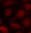 Immunofluorescence analysis of methanol-fixed MCF-7 cells using Phospho-PKCalpha/beta II-T638/641 Rabbit pAb (STJ22341).