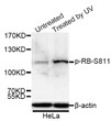 Western blot analysis of lysates from HeLa cells, using Phospho-RB-S811 Rabbit pAb (STJ22370) at 1:1000 dilution. HeLa cells were treated by UV for 15-30 minutes. <br/>Secondary antibody: HRP-conjugated Goat anti-Rabbit IgG (H+L) (STJS000856) at 1:10000 dilution. <br/>Lysates/proteins: 25 Mu g per lane. <br/>Blocking buffer: 3% BSA.