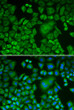 Immunofluorescence analysis of HeLa cells using Arp3 antibody (STJ22503). Blue: DAPI for nuclear staining.