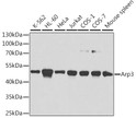 Western blot analysis of extracts of various cell lines, using Arp3 antibody (STJ22503) at 1:1000 dilution. Secondary antibody: HRP Goat Anti-Rabbit IgG (H+L) (STJS000856) at 1:10000 dilution. Lysates/proteins: 25 Mu g per lane. Blocking buffer: 3% nonfat dry milk in TBST. Detection: ECL Basic Kit.