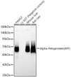 Western blot analysis of various lysates, using Alpha-Fetoprotein (AFP) Rabbit polyclonal antibody (STJ22541) at 1:400 dilution. Secondary antibody: HRP Goat Anti-Rabbit IgG (H+L) (STJS000856) at 1:10000 dilution. Lysates/proteins: 25ug per lane. Blocking buffer: 3% nonfat dry milk in TBST. Detection: ECL Basic Kit. Exposure time: 30s.