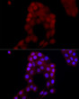 Immunofluorescence analysis of A-431 cells using AIM2 Rabbit polyclonal antibody (STJ22558) at dilution of 1:50 (40x lens). Blue: DAPI for nuclear staining.
