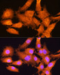 Immunofluorescence analysis of C6 cells using AIRE Rabbit polyclonal antibody (STJ22559) at dilution of 1:100. Blue: DAPI for nuclear staining.