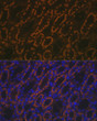 Immunofluorescence analysis of rat kidney using AMACR Rabbit polyclonal antibody (STJ22599) at dilution of 1:100 (40x lens). Blue: DAPI for nuclear staining. Immunofluorescence analysis of rat kidney using AMACR Rabbit polyclonal antibody (STJ22599) at dilution of 1:100 (40x lens). Blue: DAPI for nuclear staining.