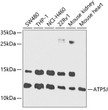 Western blot analysis of extracts of various cell lines, using ATP5J antibody (STJ22723) at 1:1000 dilution. Secondary antibody: HRP Goat Anti-Rabbit IgG (H+L) (STJS000856) at 1:10000 dilution. Lysates/proteins: 25 Mu g per lane. Blocking buffer: 3% nonfat dry milk in TBST. Detection: ECL Basic Kit. Exposure time: 90s.
