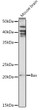 Western blot analysis of extracts of mouse brain, using Bax antibody (STJ22761) at 1:1000 dilution. Secondary antibody: HRP Goat Anti-rabbit IgG (H+L) (STJS000856) at 1:10000 dilution. Lysates/proteins: 25 Mu g per lane. Blocking buffer: 3% non-fat dry milk in TBST. Detection: ECL Basic Kit. Exposure time: 180s.