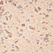 Immunohistochemistry analysis of paraffin-embedded mouse spinal cord using [KO Validated] Bax rabbit polyclonal antibody (STJ22761) at dilution of 1:100 (40x lens). Perform microwave antigen retrieval with 10 mM Tris/EDTA buffer pH 9. 0 before commencing with immunohistochemistry staining protocol.