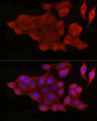 Immunofluorescence analysis of HeLa cells using [KO Validated] Bax rabbit polyclonal antibody (STJ22761) at dilution of 1:50 (40x lens). Blue: DAPI for nuclear staining.