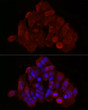 Immunofluorescence analysis of MCF7 cells using [KO Validated] Bax rabbit polyclonal antibody (STJ22761) at dilution of 1:50 (40x lens). Blue: DAPI for nuclear staining.