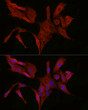 Immunofluorescence analysis of PC-12 cells using [KO Validated] Bax rabbit polyclonal antibody (STJ22761) at dilution of 1:50 (40x lens). Blue: DAPI for nuclear staining.