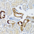 Immunohistochemistry analysis of BMP2 in paraffin-embedded mouse kidney using BMP2 Rabbit polyclonal antibody (STJ22811) at dilution of 1:50 (40x lens). Perform high pressure antigen retrieval with 10 mM citrate buffer pH 6. 0 before commencing with immunohistochemistry staining protocol.