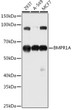 Western blot analysis of extracts of various cell lines, using BMPR1A antibody (STJ22819) at 1:1000 dilution. Secondary antibody: HRP Goat Anti-Rabbit IgG (H+L) (STJS000856) at 1:10000 dilution. Lysates/proteins: 25 Mu g per lane. Blocking buffer: 3% nonfat dry milk in TBST. Detection: ECL Basic Kit. Exposure time: 90s.