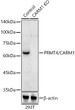 Western blot analysis of extracts from normal (control) and PRMT4/CARM1 knockout (KO) 293T cells, using PRMT4/CARM1 antibody (STJ22890) at 1:500 dilution. Secondary antibody: HRP Goat Anti-Rabbit IgG (H+L) (STJS000856) at 1:10000 dilution. Lysates/proteins: 25 Mu g per lane. Blocking buffer: 3% nonfat dry milk in TBST. Detection: ECL Basic Kit. Exposure time: 180s.