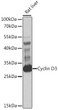 Western blot analysis of lysates from rat liver, using Cyclin D3 Rabbit pAb (STJ22951) at 1:1000 dilution. <br/>Secondary antibody: HRP-conjugated Goat anti-Rabbit IgG (H+L) (STJS000856) at 1:10000 dilution. <br/>Lysates/proteins: 25 Mu g per lane. <br/>Blocking buffer: 3% nonfat dry milk in TBST. <br/>Detection: ECL Basic Kit <br/>Exposure time: 10s.