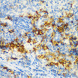Immunohistochemistry analysis of paraffin-embedded rat spleen using CD3D antibody (STJ22995) at dilution of 1:200 (40x lens). Perform microwave antigen retrieval with 10 mM PBS buffer pH 7. 2 before commencing with immunohistochemistry staining protocol.