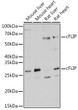 Western blot analysis of extracts of various cell lines, using cFLIP antibody (STJ23109) at 1:1000 dilution. Secondary antibody: HRP Goat Anti-Rabbit IgG (H+L) (STJS000856) at 1:10000 dilution. Lysates/proteins: 25 Mu g per lane. Blocking buffer: 3% nonfat dry milk in TBST. Detection: ECL Basic Kit. Exposure time: 10s.