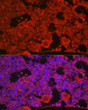 Anti-CSF1R antibody (873-972) (STJ23236)