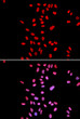 Immunofluorescence analysis of U2OS cells using DKC1 antibody (STJ23384). Blue: DAPI for nuclear staining.