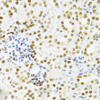 Immunohistochemistry analysis of paraffin-embedded mouse kidney using DKC1 Antibody (STJ23384) at dilution of 1:200 (40x lens). Perform microwave antigen retrieval with 10 mM PBS buffer pH 7. 2 before commencing with immunohistochemistry staining protocol.