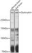 Western blot analysis of extracts of various cell lines, using Dystrophin antibody (STJ23394) at 1:1000 dilution. Secondary antibody: HRP Goat Anti-rabbit IgG (H+L) (STJS000856) at 1:10000 dilution. Lysates/proteins: 25 Mu g per lane. Blocking buffer: 3% non-fat dry milk in TBST. Detection: ECL Basic Kit. Exposure time: 10s.