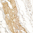 Immunohistochemistry analysis of paraffin-embedded Human skeletal muscle using Dystrophin rabbit polyclonal antibody (STJ23394) at dilution of 1:20 (40x lens). Perform high pressure antigen retrieval with 10 mM citrate buffer pH 6. 0 before commencing with immunohistochemistry staining protocol.