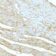 Immunohistochemistry analysis of paraffin-embedded rat heart using Dystrophin rabbit polyclonal antibody (STJ23394) at dilution of 1:20 (40x lens). Perform high pressure antigen retrieval with 10 mM citrate buffer pH 6. 0 before commencing with immunohistochemistry staining protocol.