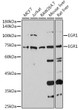 Western blot analysis of extracts of various cell lines, using EGR1 antibody (STJ23496) at 1:1000 dilution. Secondary antibody: HRP Goat Anti-Rabbit IgG (H+L) (STJS000856) at 1:10000 dilution. Lysates/proteins: 25 Mu g per lane. Blocking buffer: 3% nonfat dry milk in TBST. Detection: ECL Enhanced Kit. Exposure time: 10s.
