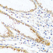 Immunohistochemistry analysis of paraffin-embedded human stomach using FAM3B antibody (STJ23622) at dilution of 1:100 (40x lens). Perform microwave antigen retrieval with 10 mM PBS buffer pH 7. 2 before commencing with immunohistochemistry staining protocol.