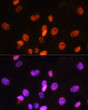 Immunofluorescence analysis of C6 cells using FANCD2 Rabbit polyclonal antibody (STJ23624) at dilution of 1:100. Secondary antibody: Cy3 Goat Anti-Rabbit IgG (H+L) at 1:500 dilution. Blue: DAPI for nuclear staining.