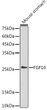 Western blot analysis of extracts of Mouse stomach, using FGF10 antibody (STJ23652) at 1:1000 dilution. Secondary antibody: HRP Goat Anti-Rabbit IgG (H+L) (STJS000856) at 1:10000 dilution. Lysates/proteins: 25 Mu g per lane. Blocking buffer: 3% nonfat dry milk in TBST. Detection: ECL Enhanced Kit. Exposure time: 180s.