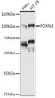 Western blot analysis of various lysates using FOXM1 Rabbit polyclonal antibody (STJ23701) at 1:1000 dilution. Secondary antibody: HRP Goat Anti-Rabbit IgG (H+L) (STJS000856) at 1:10000 dilution. Lysates/proteins: 25 Mu g per lane. Blocking buffer: 3% nonfat dry milk in TBST. Detection: ECL Basic Kit. Exposure time: 90s.