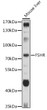 Western blot analysis of lysates from Mouse liver, using FSHR Rabbit polyclonal antibody (STJ23714) at 1:1000 dilution. Secondary antibody: HRP Goat Anti-Rabbit IgG (H+L) (STJS000856) at 1:10000 dilution. Lysates/proteins: 25 Mu g per lane. Blocking buffer: 3% nonfat dry milk in TBST. Detection: ECL Basic Kit. Exposure time: 30s.