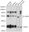 Western blot analysis of extracts of various cell lines, using GFRA2 antibody (STJ23776) at 1:1000 dilution. Secondary antibody: HRP Goat Anti-Rabbit IgG (H+L) (STJS000856) at 1:10000 dilution. Lysates/proteins: 25 Mu g per lane. Blocking buffer: 3% nonfat dry milk in TBST. Detection: ECL Basic Kit. Exposure time: 5s.
