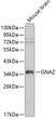 Western blot analysis of lysates from mouse brain, using GNAZ Rabbit pAb (STJ23817). <br/>Secondary antibody: HRP-conjugated Goat anti-Rabbit IgG (H+L) (STJS000856) at 1:10000 dilution. <br/>Lysates/proteins: 25 Mu g per lane. <br/>Blocking buffer: 3% nonfat dry milk in TBST.