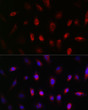 Immunofluorescence analysis of U-251MG cells using GNB3 Rabbit polyclonal antibody (STJ23822) at dilution of 1:50 (40x lens). Blue: DAPI for nuclear staining.