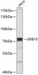 Western blot analysis of extracts of HeLa cells, using GRB10 antibody (STJ23854) at 1:1000 dilution. Secondary antibody: HRP Goat Anti-Rabbit IgG (H+L) (STJS000856) at 1:10000 dilution. Lysates/proteins: 25 Mu g per lane. Blocking buffer: 3% nonfat dry milk in TBST. Detection: ECL Basic Kit. Exposure time: 60s.