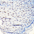Immunohistochemistry analysis of paraffin-embedded human esophageal using GTPBP4 Rabbit polyclonal antibody (STJ23895) at dilution of 1:50 (40x lens). Perform high pressure antigen retrieval with 10 mM citrate buffer pH 6. 0 before commencing with immunohistochemistry staining protocol.