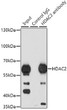Immunoprecipitation analysis of 200 Mu g extracts of K562 cells using 1 Mu g HDAC2 antibody (STJ23929). Western blot was performed from the immunoprecipitate using HDAC2 antibody (STJ23929) at a dilution of 1:1000.