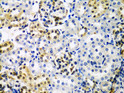 Immunohistochemistry analysis of HDAC2 in paraffin-embedded rat kidney using HDAC2 Rabbit polyclonal antibody (STJ23929) at dilution of 1:100 (40x lens). Perform microwave antigen retrieval with 10 mM PBS buffer pH 7. 2 before commencing with immunohistochemistry staining protocol.