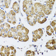 Immunohistochemistry analysis of paraffin-embedded human stomach using HDAC6 antibody (STJ23932) at dilution of 1:100 (40x lens). Perform microwave antigen retrieval with 10 mM PBS buffer pH 7. 2 before commencing with immunohistochemistry staining protocol.