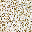 Immunohistochemistry analysis of MonoMethyl-Histone H3-K4 in paraffin-embedded mouse stomach using MonoMethyl-Histone H3-K4 Rabbit polyclonal antibody (STJ23981) at dilution of 1:200 (40x lens). Perform high pressure antigen retrieval with 10 mM citrate buffer pH 6. 0 before commencing with immunohistochemistry staining protocol.